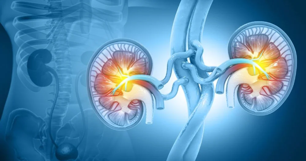 Acute Kidney Injury (AKI)