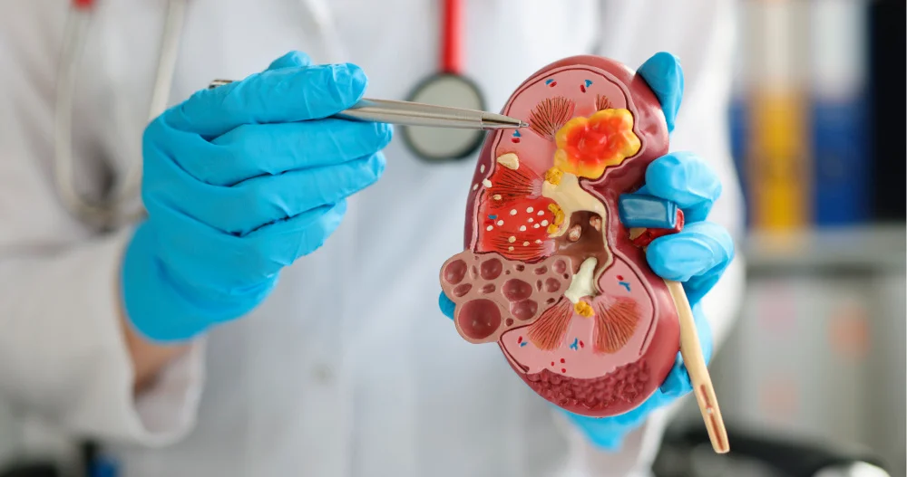 Chronic Kidney Disease (CKD)