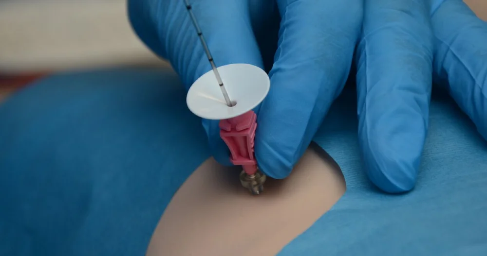 Kidney Biopsy